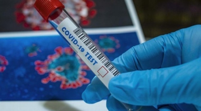 Nos encontramos en una situación critica, personas de 20 a 35 años las más afectadas por COVID: médico