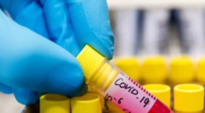 Variante Lambda del COVID-19 alarma por alta infecciosidad y resistencia a vacunas