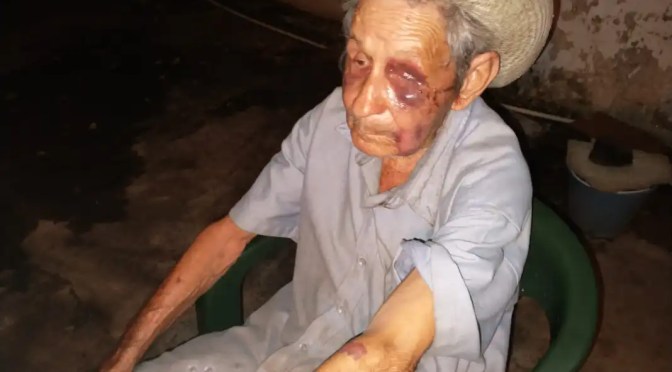 Adulto mayor de Soconusco fue golpeado en su domicilio para robarle